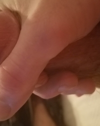 photo-thumb