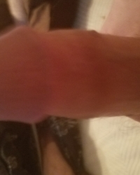 photo-thumb