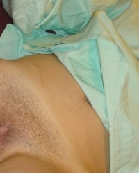 photo-thumb