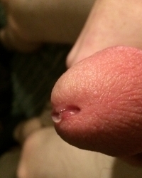 photo-thumb