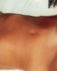 photo-thumb
