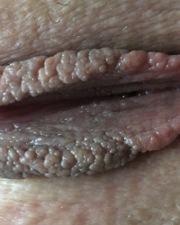 photo-thumb