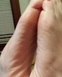 photo-thumb