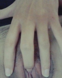 photo-thumb