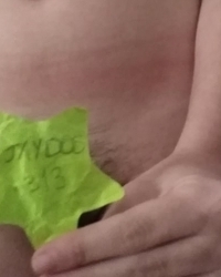photo-thumb