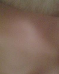 photo-thumb