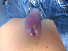 Thumb 13